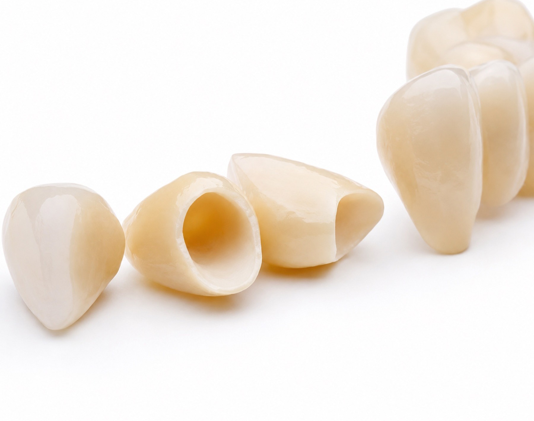 Dental Crowns Guide