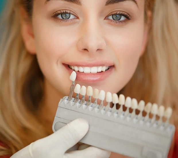 Dental Veneers