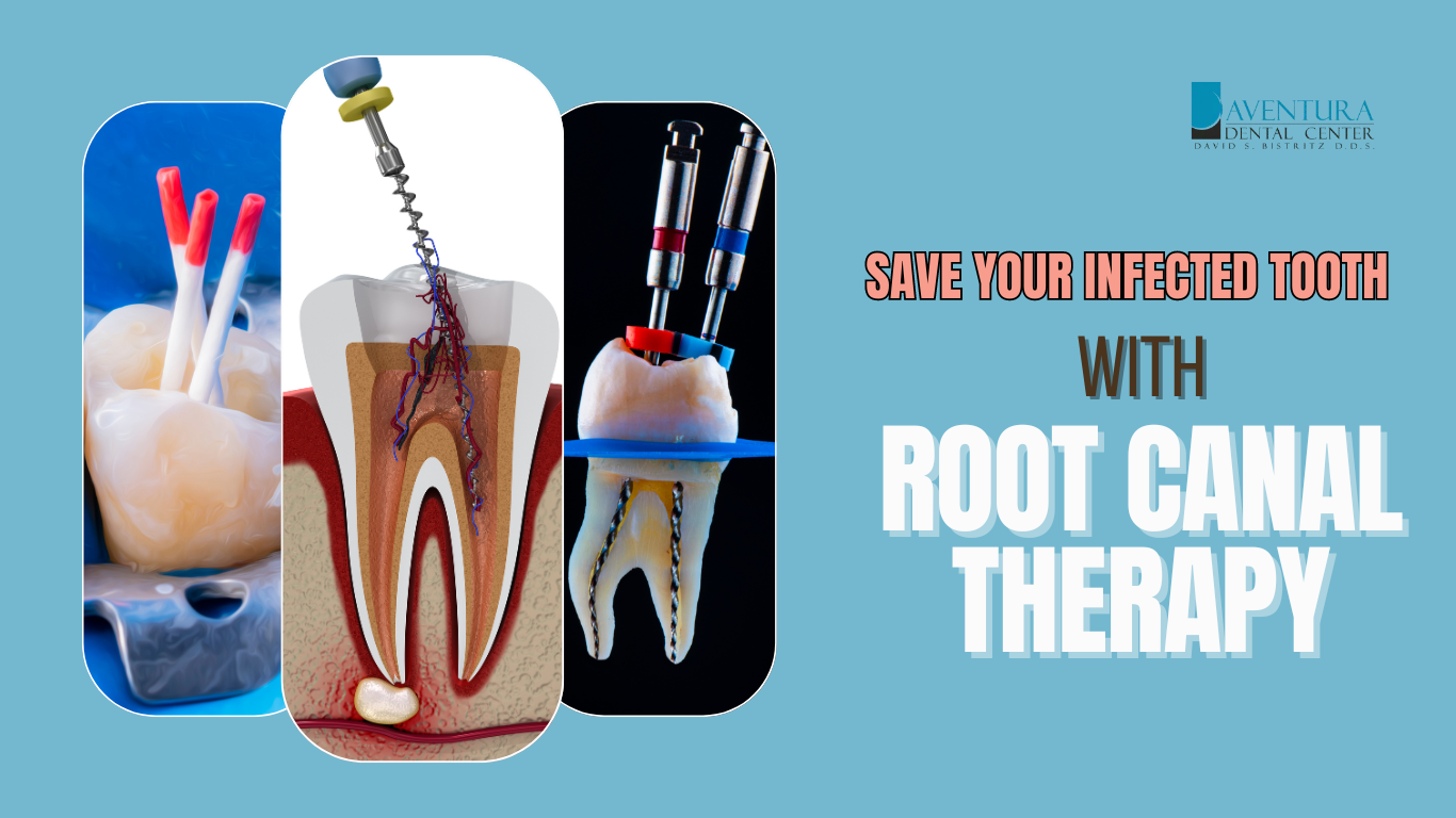 Dr. Bistritz in Aventura, FL: Root Canal Treatment to Release Your Pain