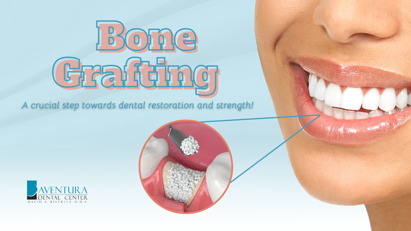 Top Bone Grafting Treatment in Aventura, FL by Dr. Bistritz