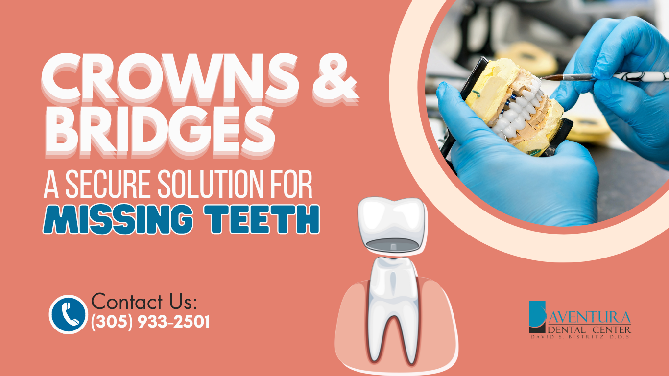 Crowns and Bridges Treatment in Aventura, FL with Dr. Bistritz: Restore Your Smile